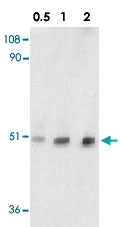 PAB12888 - TTC5