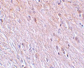 PAB12888 - TTC5
