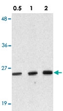 PAB12889 - DEDD2