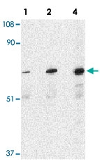 PAB12890 - PAK6