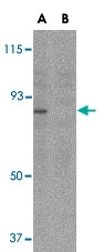 PAB12893 - AICDA / AID