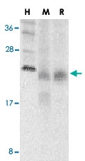 PAB12894 - CD268 / BAFFR