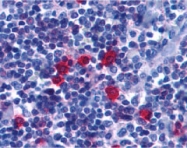 PAB12894 - CD268 / BAFFR