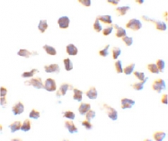 PAB12895 - NLRC4