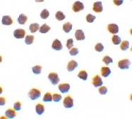 PAB12896 - TRAF6 / RNF85
