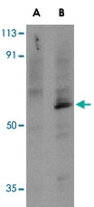 PAB12896 - TRAF6 / RNF85