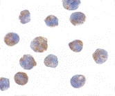 PAB12899 - ANP32A