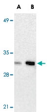 PAB12899 - ANP32A