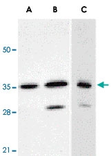 PAB12900 - ANP32E