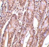 PAB12900 - ANP32E