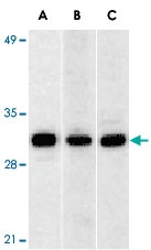 PAB12901 - ANP32A