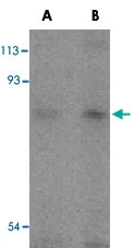 PAB12905 - TICAM1 / TRIF