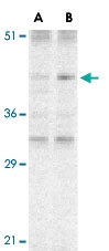 PAB12906 - CARD8 / NDPP1
