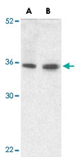 PAB12910 - TRIM5 / RNF88
