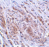 PAB12910 - TRIM5 / RNF88