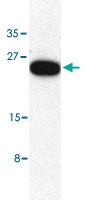 PAB12911 - TRIM5 / RNF88