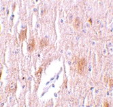 PAB12911 - TRIM5 / RNF88