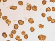 PAB12917 - SARM1