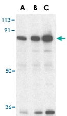 PAB12917 - SARM1