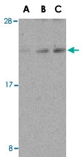 PAB12919 - DAD1
