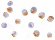 PAB12920 - NAIP