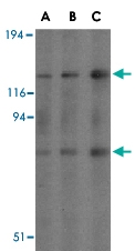 PAB12921 - AGAP2 / CENTG1