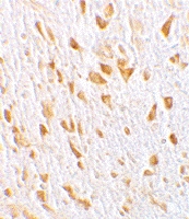 PAB12921 - AGAP2 / CENTG1