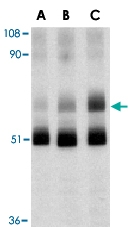 PAB12922 - IAP2 / BIRC2