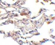 PAB12922 - IAP2 / BIRC2