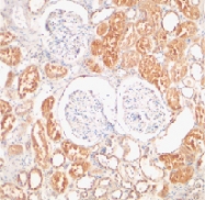 PAB12923 - IAP3 / BIRC4