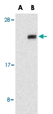 PAB12928 - NADE / BEX3