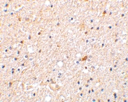 PAB12928 - NADE / BEX3