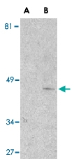 PAB12929 - IL1RL1 / ST2