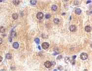 PAB12929 - IL1RL1 / ST2
