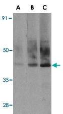PAB12930 - SIGIRR / TIR8