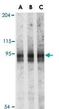 PAB12931 - RNF216