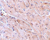 PAB12931 - RNF216