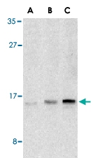 PAB12933 - UBE2V1