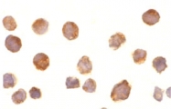 PAB12936 - BTK