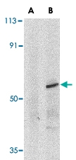 PAB12937 - IRF8 / ICSBP1