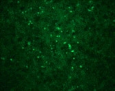 PAB12942 - West Nile Virus