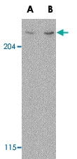 PAB12944 - mTOR / FRAP1
