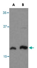 PAB12945 - LST8 / GBL