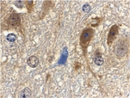 PAB12945 - LST8 / GBL