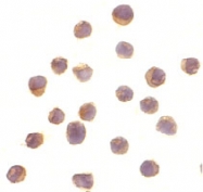 PAB12946 - RPS6KA1