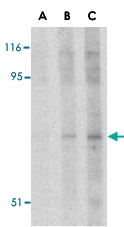 PAB12946 - RPS6KA1