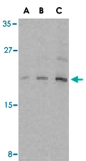PAB12947 - EIF4EBP1 / 4E-BP1