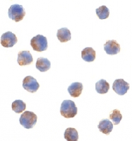PAB12949 - IRS1
