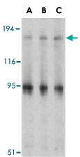 PAB12949 - IRS1