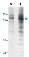 PAB12957 - CD107a / LAMP1